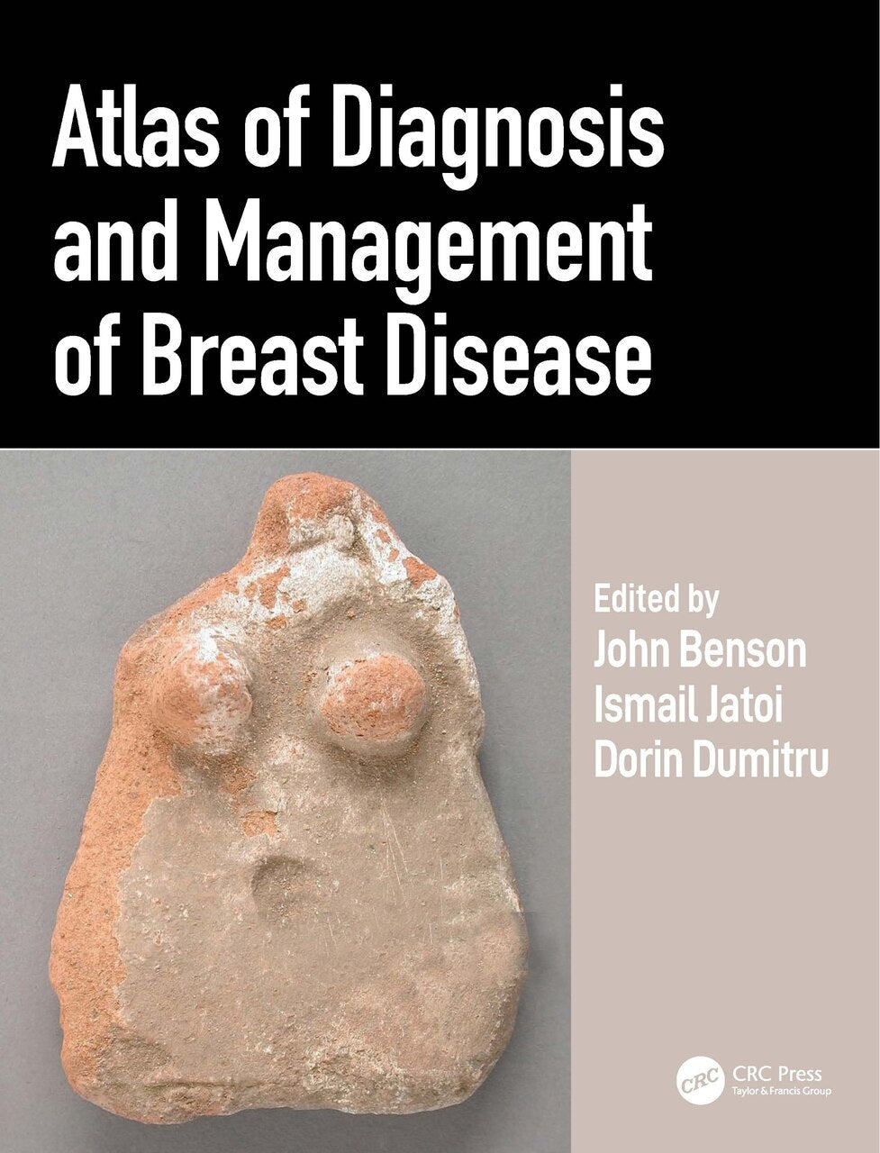 Atlas of Diagnosis and Management of Breast Disease - image 1