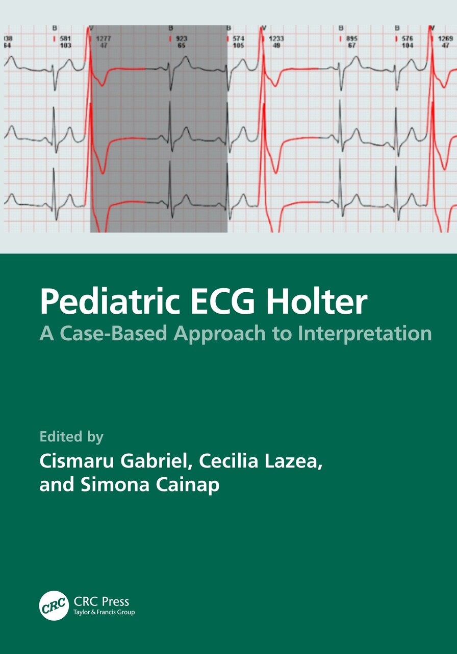 Pediatric ECG Holter: A Case-based Approach to Interpretation - image 1
